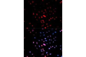 Immunofluorescence analysis of U2OS cell using Phospho-c-Jun-Ser73 antibody. (C-JUN Antikörper  (pSer73))