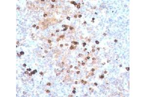 IHC testing of human tonsil stained with IgM heavy chain antibody. (Maus anti-Human IgM Heavy Chain Antikörper)
