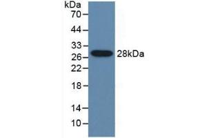 Western blot analysis of recombinant Mouse CYP2E1. (CYP2E1 Antikörper  (AA 34-273))