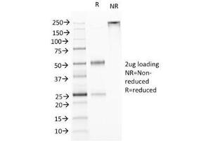 SDS-PAGE Analysis of Purified, BSA-Free TL1A Antibody (clone VEGI/1283). (TNFSF15 Antikörper)