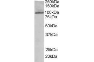 Western Blotting (WB) image for anti-TAO Kinase 3 (TAOK3) (Internal Region) antibody (ABIN2465861) (TAO Kinase 3 Antikörper  (Internal Region))