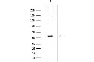 anti-Tropomodulin 1 (TMOD1) (N-Term) antibody