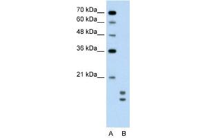 UBE2L3 antibody used at 0. (UBE2L3 Antikörper  (C-Term))