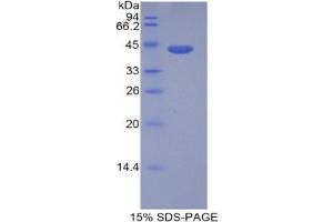 SDS-PAGE analysis of Human HIST1H2AD Protein.