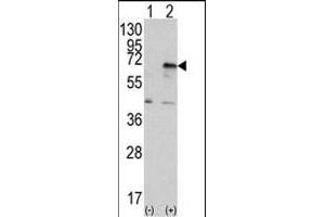 Western blot analysis of EIF2AK2 (arrow) using PRKR Antibody (C-term) (ABIN392779 and ABIN2837995). (EIF2AK2 Antikörper  (C-Term))