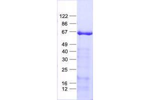 Validation with Western Blot (TRIM9 Protein (His tag))