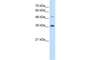 Western Blotting (WB) image for anti-Iroquois Homeobox Protein 1 (IRX1) antibody (ABIN2463089) (IRX1 Antikörper)