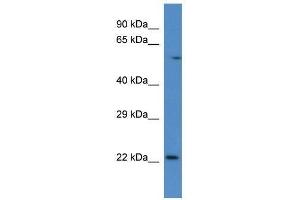 Western Blot showing Rab10 antibody used at a concentration of 1. (RAB10 Antikörper  (C-Term))