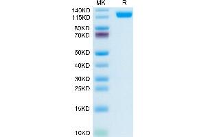 Human CD13/ANPEP on Tris-Bis PAGE under reduced condition. (CD13 Protein (AA 69-967) (His tag))