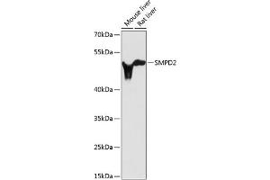 Western blot analysis of extracts of various cell lines, using SMPD2 antibody (ABIN3021604, ABIN3021605, ABIN3021606 and ABIN6215351) at 1:3000 dilution. (SMPD2 Antikörper  (AA 150-250))