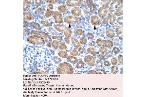 Immunohistochemistry (IHC) image for anti-POU Domain, Class 4, Transcription Factor 3 (POU4F3) (Middle Region) antibody (ABIN2777732)