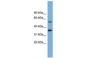 SLC7A7 antibody used at 1 ug/ml to detect target protein. (SLC7A7 Antikörper)