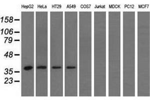 Western blot analysis of extracts (35 µg) from 9 different cell lines by using anti-HIBCH monoclonal antibody. (HIBCH Antikörper)