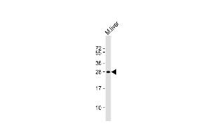 Anti-MOUSE Sike1 Antibody (N-term) at 1:1000 dilution + mouse liver lysate Lysates/proteins at 20 μg per lane. (SIKE1 Antikörper  (N-Term))