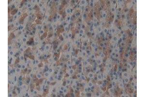 IHC-P analysis of Rat Stomach Tissue, with DAB staining.