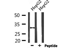 Western blot analysis of extracts from HepG2, using HO-1 Antibody. (HMOX1 Antikörper  (Internal Region))