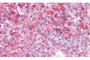 Detection of GBA in Human Spleen Tissue using Polyclonal Antibody to Glucocerebrosidase (GBA) (GBA Antikörper  (AA 334-498))