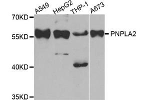 Western blot analysis of extracts of various cell lines, using PNPLA2 antibody. (PNPLA2 Antikörper)