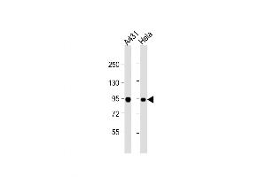 Western Blot at 1:1000 dilution Lane 1: A431 whole cell lysate Lane 2: Hela whole cell lysate Lysates/proteins at 20 ug per lane. (HSP90AB1 Antikörper  (AA 403-431))