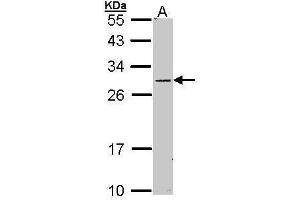 WB Image Sample (30 ug of whole cell lysate) A: Molt-4 , 12% SDS PAGE antibody diluted at 1:1000 (STAR Antikörper)