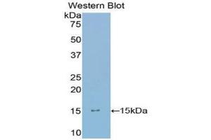 Western Blotting (WB) image for anti-Ly1 Antibody Reactive (LYAR) (AA 288-379) antibody (ABIN1859731) (LYAR Antikörper  (AA 288-379))