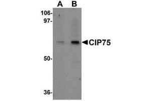 Western blot analysis of CIP75 in 3T3 cell lysate with AP30234PU-N CIP75 antibody at (A) 1 and (B) 2 μg/ml. (UBQLN4 Antikörper  (N-Term))