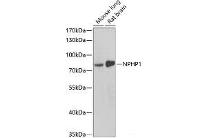 Western blot analysis of extracts of various cell lines using NPHP1 Polyclonal Antibody at dilution of 1:1000. (NPHP1 Antikörper)