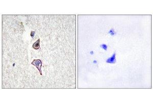 Immunohistochemistry (IHC) image for anti-Mannose Receptor, C Type 2 (MRC2) (N-Term) antibody (ABIN1850036) (MRC2 Antikörper  (N-Term))
