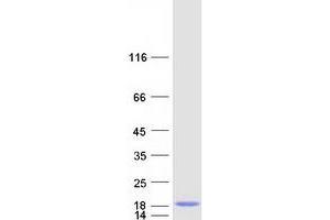 Western Blotting (WB) image for Nuclear Receptor 2C2-Associated Protein (NR2C2AP) protein (Myc-DYKDDDDK Tag) (ABIN2727575)