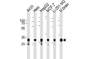 Western blot analysis of lysates from A431, Hela, HepG2, MCF-7, U-251 MG cell lines and mouse brain tissue lysate (from left to right), using CYC1 Antibody (Center) (ABIN1944852 and ABIN2838554).