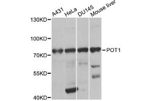 Western blot analysis of extracts of various cell lines, using POT1 antibody (ABIN2650945) at 1:1000 dilution. (POT1 Antikörper)