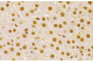Immunohistochemistry of paraffin-embedded Rat liver using CDC25A Polyclonal Antibody at dilution of 1:100 (40x lens). (CDC25A Antikörper)