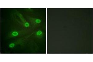 Immunofluorescence analysis of HeLa cells, using p53 (Acetyl-Lys386) Antibody. (p53 Antikörper  (acLys386))