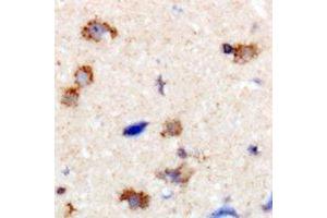 Immunohistochemical analysis of Dynamin 1 staining in human brain formalin fixed paraffin embedded tissue section. (Dynamin 1 Antikörper  (C-Term))