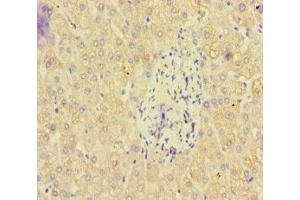 Immunohistochemistry of paraffin-embedded human liver tissue using ABIN7162471 at dilution of 1:100 (PAN2 Antikörper  (AA 628-908))