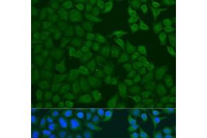 Immunofluorescence analysis of U2OS cells using FERMT3 Polyclonal Antibody at dilution of 1:100. (FERMT3 Antikörper)