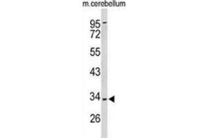 Western blot analysis of Peroxin 2 / PEX2 / RNF72 (arrow) in mouse cerebellum tissue lysates (35ug/lane) using Peroxin 2 / PEX2 / RNF72  (PEX2 Antikörper  (Middle Region))