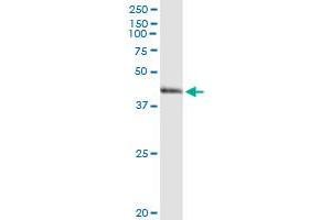 Western Blotting (WB) image for anti-Arginase, Type II (ARG2) (AA 1-354) antibody (ABIN947579)