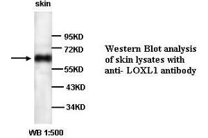 Image no. 1 for anti-Lysyl Oxidase-Like 1 (LOXL1) antibody (ABIN790875) (LOXL1 Antikörper)