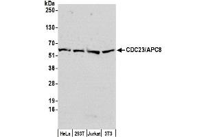 Western Blotting (WB) image for anti-Cell Division Cycle 23 (CDC23) (AA 125-175) antibody (ABIN7451688)