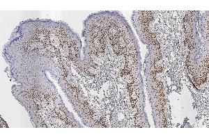 Human skin: immunohistochemical staining for Androgen Receptor. (Androgen Receptor Antikörper  (N-Term))