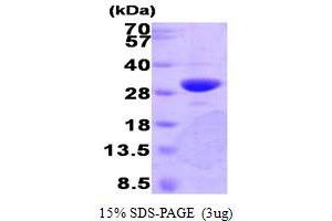 SDS-PAGE (SDS) image for Phenylethanolamine N-Methyltransferase (PNMT) (AA 1-282) protein (ABIN666907) (PNMT Protein (AA 1-282))