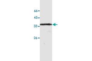 Western blot analysis of HeLa whole cell lystae with ANXA10 monoclonal antibody, clone 24  at 1:500 dilution. (Annexin a10 Antikörper  (AA 168-324))