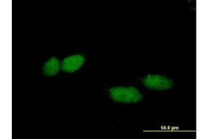 Immunofluorescence of purified MaxPab antibody to TBL1X on HeLa cell. (TBL1X Antikörper  (AA 1-526))