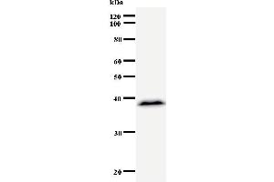 Western Blotting (WB) image for anti-ATP-Binding Cassette, Sub-Family F (GCN20), Member 1 (ABCF1) antibody (ABIN930906)
