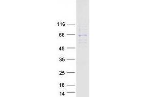 Validation with Western Blot (TROVE2 Protein (Transcript Variant 3) (Myc-DYKDDDDK Tag))