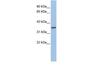WB Suggested Anti-PHF13 Antibody Titration:  0.