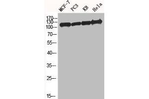Western Blot analysis of MCF7 PC-3 KB HELA cells using BM28 Polyclonal Antibody (MCM2 Antikörper  (N-Term))