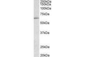 Image no. 1 for anti-Hypermethylated in Cancer 2 (HIC2) (AA 188-200) antibody (ABIN1102028) (HIC2 Antikörper  (AA 188-200))
