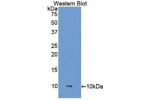 Western blot analysis of the recombinant protein. (HPSE Antikörper  (AA 27-101))